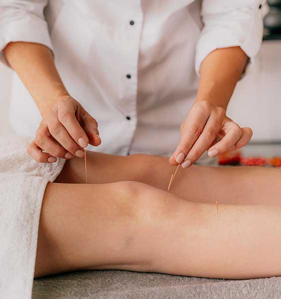 acupuncture therapy