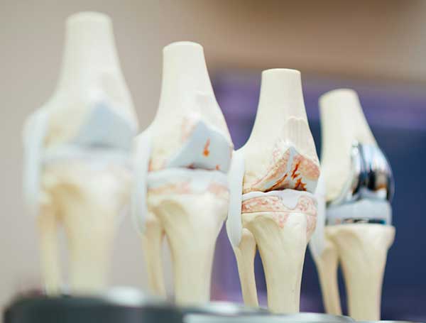 Osteopathy, Lakeshore, ON